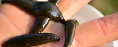 Hirudoterapia na wikipedii